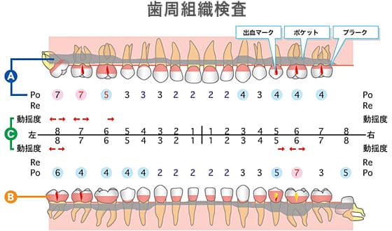 歯周組織検査